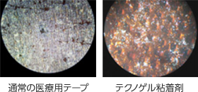 通常の医療用テープ、テクノゲル粘着剤